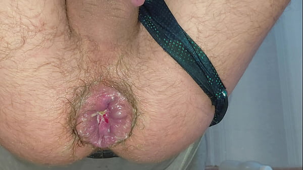 Ein gedehnter Anus gibt den Blick auf einen Hämorrhoidenvorfall frei, der durch das Reiten auf einer riesigen Flasche entstanden ist. Unglaubliches Hardcore-Fisting zu Hause.